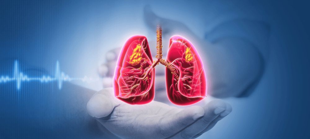 Lung Cancer