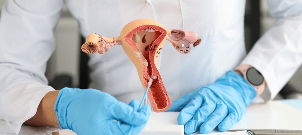 Endometrial Cancer